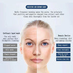 Ionic Anti-Wrinkle Face Massager – Electronic Skin Tightening & Whitening Beauty Device