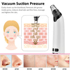 Facial Cleaner Black Point Vacuum Suction, Beauty Blackhead Remover, Black Head Dots Extractor Skin Care Tool
