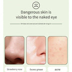 Deep Cleansing Facial Skin Scrubber | Face Spatula Exfoliator & Blackhead Pore Cleaner